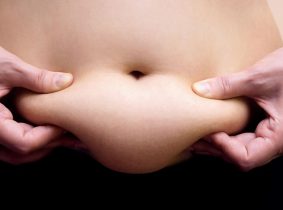 Recovery of the Stomach after a Sleeve Gastrectomy