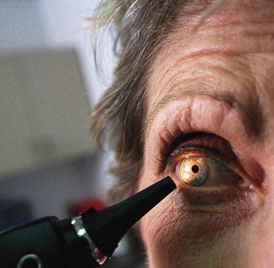 Cataract Surgery for Different Age Groups: What to Know