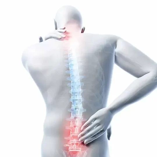 spinal cord stimulation