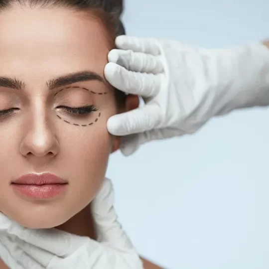 Eyelid Surgery